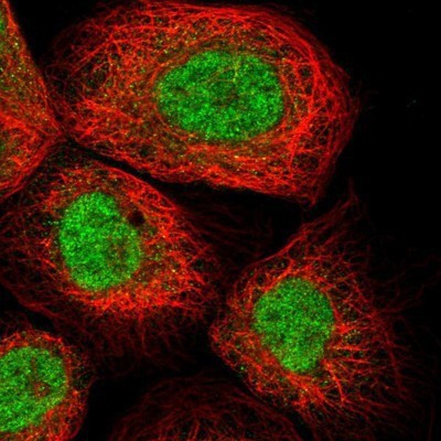 Immunocytochemistry/Immunofluorescence: NMD3 Antibody [NBP1-84524] - Staining of human cell line A-431 shows positivity in nucleus.