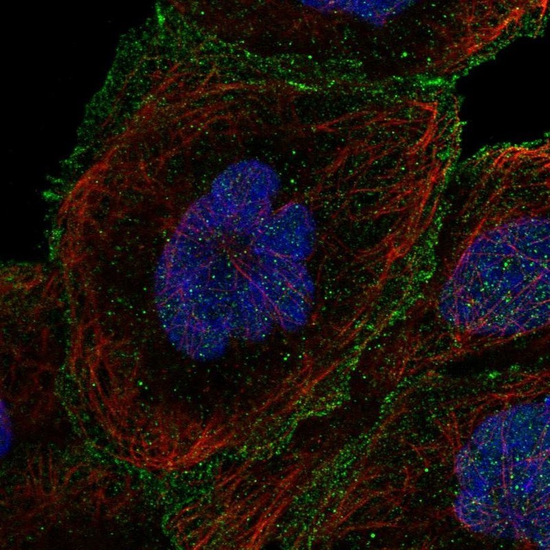 Immunocytochemistry/Immunofluorescence: KCNIP4 Antibody [NBP1-86655] - Immunofluorescent staining of human cell line A-431 shows positivity in nucleus & plasma membrane.