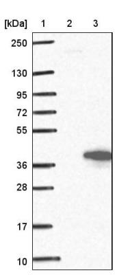 Western Blot: Morg1 Antibody [NBP1-92133] - Lane 1: Marker [kDa] 250, 130, 95, 72, 55, 36, 28, 17, 10<br/>Lane 2: Negative control (vector only transfected HEK293T lysate)<br/>Lane 3: Over-expression lysate (Co-expressed with a C-terminal myc-DDK tag (~3.1 kDa) in mammalian HEK293T cells, LY403158)