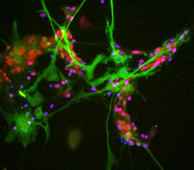 Immunocytochemistry/Immunofluorescence: Aldolase C Antibody (4A9) [NBP2-25145] - View of mixed neuron/glial cultures stained with NBP2-25145 (green) and the rabbit antibody to RBFOX3/NeuN (NBP1-92716, red). NBP2-25145 reveals strong cytoplasmic staining in astrocytes, while the rabbit RBFOX3/NeuN antibody shows nuclear and distal cytoplasmic staining in neuron cells and complete absence of astrocytes. Blue is a DNA stain.