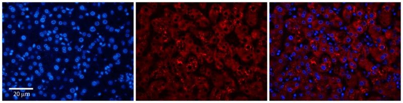 Immunocytochemistry/Immunofluorescence: OVCA1 Antibody [NBP1-56693] - Formalin Fixed Paraffin; Embedded Tissue: Human Adult Liver; Observed Staining: Cytoplasm (perinuclear) but not nuclear in hepatocytes, strong signal, low tissue distribution; Primary Antibody Concentration: 1:100