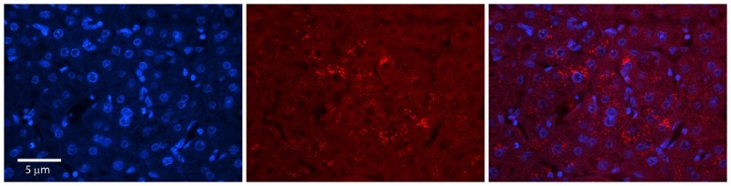 Immunocytochemistry/Immunofluorescence: SZRD1 Antibody [NBP1-57737] - Antibody  Formalin Fixed Paraffin Embedded Tissue: Human Adult Liver  Observed Staining: Cytoplasm in hepatocytes, moderate signal, moderate tissue distribution