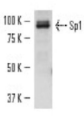 Western Blot: SP1 Antibody [NB100-92229] - Western blot (WB) analysis of SP1 (G447) antibody in  K-562 (A) and A-431 (B) whole cell lysates