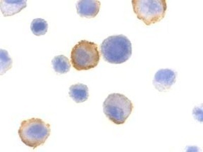 Immunocytochemistry/Immunofluorescence: Bmf Antibody [NBP1-76658] - HeLa cells with Bmf antibody at 10 ug/ml.