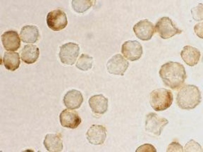 Immunocytochemistry/Immunofluorescence: MTA2 Antibody [NBP1-76748] - Immunocytochemical analysis of PID in formalin-fixed HeLa cells using NBP1-76748 at 10 ug/ml.
