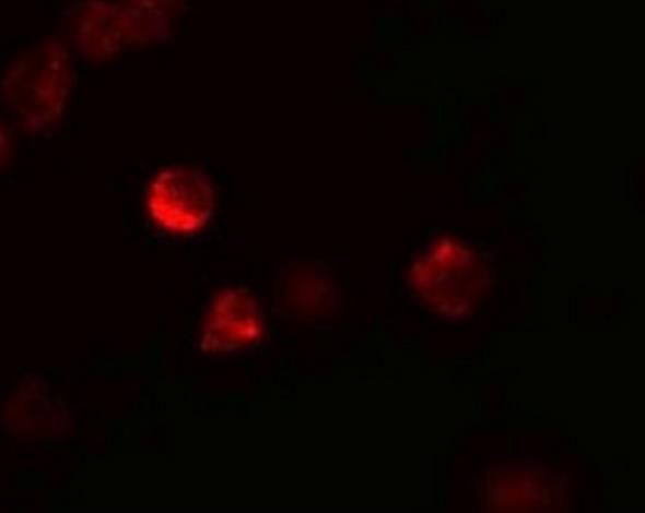 Immunocytochemistry/Immunofluorescence: LIF Antibody [NBP1-76554] - 3T3 cells.
