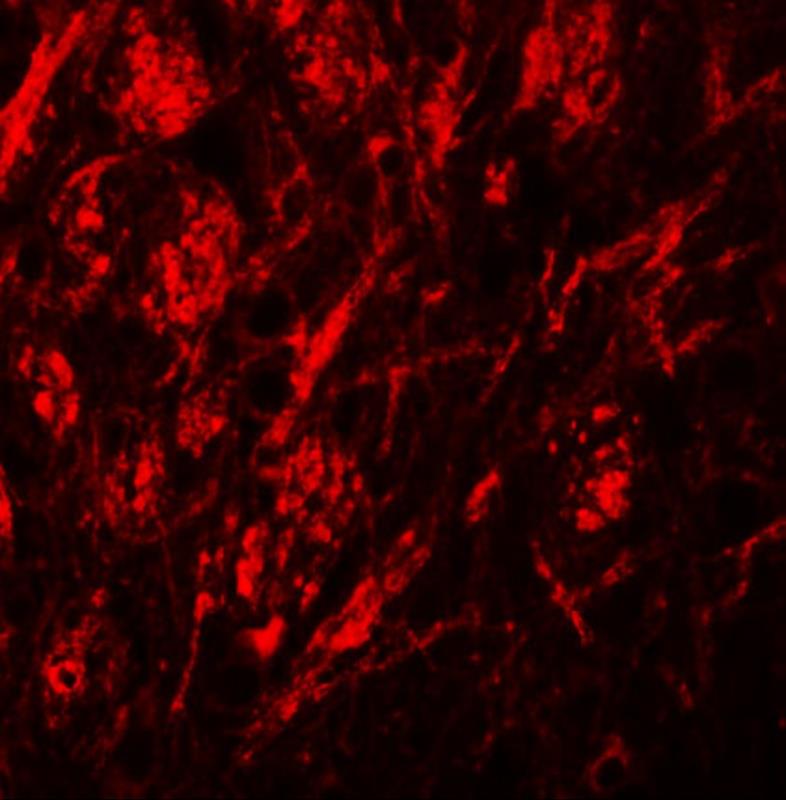 Immunocytochemistry/Immunofluorescence: SLC39A9/ZIP9 Antibody [NBP1-76506] - Immunofluorescence of ZIP9 in human brain tissue with ZIP9 antibody at 20 ug/mL.