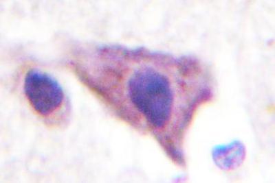 Immunohistochemistry-Paraffin: KIR5.1 Antibody [NBP1-00899] - Paraffin-embedded human brain tissue .
