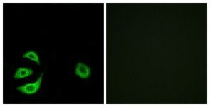 Immunocytochemistry/Immunofluorescence: ACOT8 Antibody [NBP1-66562] - Analysis of A549 cells, using ACOT8 Antibody. The picture on the right is treated with the synthesized peptide.