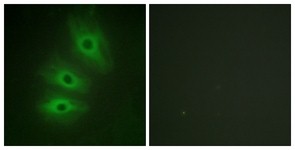 Immunocytochemistry/Immunofluorescence: Adenylate Cyclase 5/6 Antibody [NBP1-66413] - Analysis of HeLa cells, using Adenylate Cyclase 5/6 Antibody. The picture on the right is treated with the synthesized peptide.
