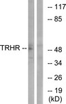 Western Blot: Thyrotropin-Releasing Hormone Receptor Antibody [NBP1-71368] - Analysis of extracts from COS7 cells, using Thyrotropin-Releasing Hormone Receptor Antibody. The lane on the right is treated with the synthesized peptide.