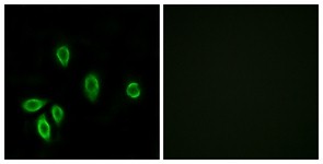 Immunocytochemistry/Immunofluorescence: Thyrotropin-Releasing Hormone Receptor Antibody [NBP1-71368] - Analysis of A549 cells, using Thyrotropin-Releasing Hormone Receptor Antibody. The picture on the right is treated with the synthesized peptide.