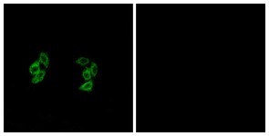Immunocytochemistry/Immunofluorescence: CSNK1A1L Antibody [NBP1-55676] - Analysis of A549 cells, using CSNK1A1L Antibody. The picture on the right is treated with the synthesized peptide.