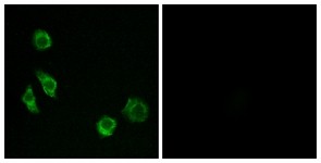Immunocytochemistry/Immunofluorescence: GPRC5D Antibody [NBP1-71070] - Analysis of MCF7 cells, using GPRC5D Antibody. The picture on the right is treated with the synthesized peptide.