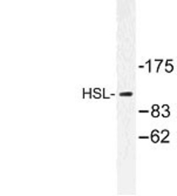 Western Blot: Galanin Receptor GalR2 Antibody [NBP1-00842] - Western blot (WB) analysis of HSL (A546) antibody in extracts from Jurkat cells
