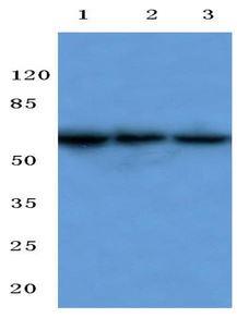 Western Blot: Beta 3 Adrenergic Receptor Antibody [NBP1-00716] - Analysis of Beta 3 Adrenergic Receptor (L291) pAb at 1:500 dilution. Lane1:MCF-7 whole cell lysate. Lane2:Mouse Kidney tissue lysate Lane3:Rat Liver tissue lysate.