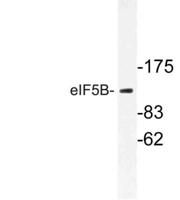 Western Blot: Eukaryotic translation initiation factor 5B Antibody [NBP1-30511] - Analysis of eIF5B (H1086) pAb in extracts from Jurkat cells.