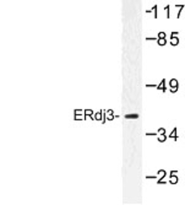 Western Blot: ERdj3 Antibody [NBP1-00814] - Western blot (WB) analysis of ERdj3 (K66) antibody in extracts from HeLa cells