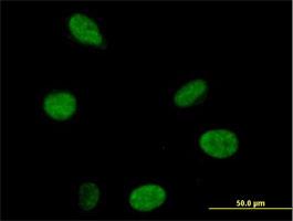 Immunocytochemistry/Immunofluorescence: DHX16 Antibody [H00008449-B01] - Immunofluorescence of purified MaxPab antibody to DHX16 (Cat# H00008449-B01) on HeLa cell . [antibody concentration 10 ug/ml]