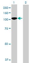 Western Blot: BCOR Antibody [H00054880-B01] - analysis of BCOR expression in transfected 293T cell line by BCOR MaxPab polyclonal antibody (B01). Lane 1: BCOR transfected lysate (107.40 KDa). Lane 2: Non-transfected lysate.