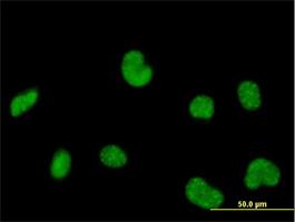 Immunocytochemistry/Immunofluorescence: RPC62 Antibody [H00010623-B01] - Immunofluorescence of purified MaxPab antibody to POLR3C on HeLa cell. [antibody concentration 10 ug/ml]