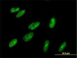 Immunocytochemistry/Immunofluorescence: ZBTB22 Antibody [H00009278-B01] - Immunofluorescence of purified MaxPab antibody to ZBTB22 on HepG2 cell. [antibody concentration 10 ug/ml]
