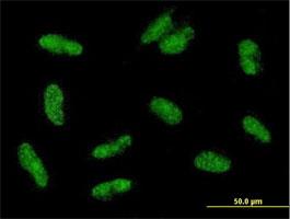 Immunocytochemistry/Immunofluorescence: VGLL2 Antibody [H00245806-B01] - Immunofluorescence of purified MaxPab antibody to VGLL2 on HepG2 cell. [antibody concentration 10 ug/ml]