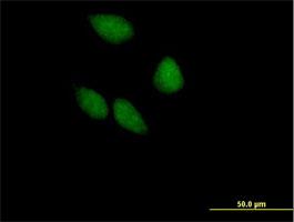 Immunocytochemistry/Immunofluorescence: EIF3F Antibody [H00008665-B01] - Immunofluorescence of purified MaxPab antibody to EIF3S5 on HeLa cell. [antibody concentration 10 ug/ml]