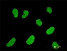 Immunocytochemistry/Immunofluorescence: NFATC2IP Antibody (2D7-A10) [H00084901-M01] - Immunofluorescence of monoclonal antibody to NFATC2IP on HeLa cell . [antibody concentration 10 ug/ml]