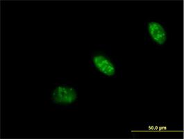 Immunocytochemistry/Immunofluorescence: PRAF1 Antibody [H00064425-B01] - Immunofluorescence of purified MaxPab antibody to PRAF1 ( Cat# H00064425-B01 ) on HeLa cell . [antibody concentration 10 ug/ml]