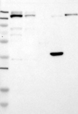 Western Blot: SETD5 Antibody [22560002] - Samples:  Lane 1, Marker [kDa]: 250, 130, 95, 72, 55, 36, 28, 17, 11  Lane 2, RT-4  Lane 3, U-251MG sp  Lane 4, Human Plasma  Lane 5, Liver  Lane 6, Tonsil ,  Target weight [kDa]:  159, 158, 147, 101, 99 (splice variants)   Validation score:   2   Validation description:   Supportive - Band of predicted size in kDa (+/-20%) with additional bands present.