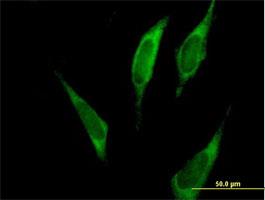 Immunocytochemistry/Immunofluorescence: FARSLA Antibody [H00002193-B01] - Immunofluorescence of purified MaxPab antibody to FARSLA on HeLa cell. [antibody concentration 10 ug/ml]