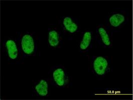 Immunocytochemistry/Immunofluorescence: SART3 Antibody [H00009733-B01] - Immunofluorescence of purified MaxPab antibody to SART3 on HeLa cell. [antibody concentration 10 ug/ml]