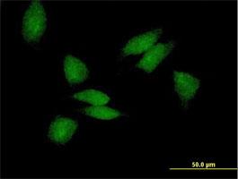 Immunocytochemistry/Immunofluorescence: PABPC3 Antibody [H00005042-B01P] - Immunofluorescence of purified MaxPab antibody to PABPC3 on HeLa cell. [antibody concentration 10 ug/ml]