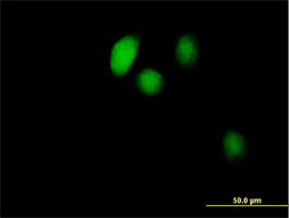 Immunocytochemistry/Immunofluorescence: BOLA1 Antibody [H00051027-B01] - Immunofluorescence of purified MaxPab antibody to BOLA1 ( Cat# H00051027-B01 ) on HeLa cell . [antibody concentration 10 ug/ml]