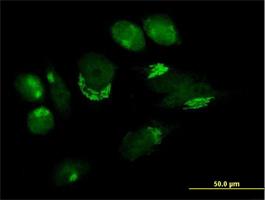 Immunocytochemistry/Immunofluorescence: B4GALT4 Antibody [H00008702-B01] - Immunofluorescence of purified MaxPab antibody to B4GALT4 on HeLa cell. [antibody concentration 10 ug/ml]