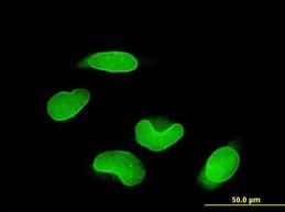 Immunocytochemistry/Immunofluorescence: RUNX1T1/ETO Antibody (5A12) [H00000862-M01] - HeLa cells.