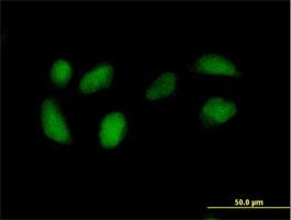 Immunocytochemistry/Immunofluorescence: RPE Antibody [H00006120-B01] - Immunofluorescence of purified MaxPab antibody to RPE on HeLa cell. [antibody concentration 10 ug/ml]