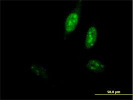 Immunocytochemistry/Immunofluorescence: DNA Polymerase epsilon Antibody [H00054107-B02] - Immunofluorescence of purified MaxPab antibody to POLE3 on HeLa cell. [antibody concentration 10 ug/ml]