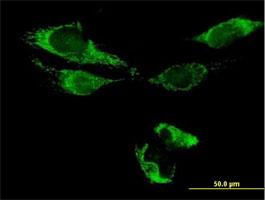 Immunocytochemistry/Immunofluorescence: ATAD3B Antibody [H00083858-B01P] - Immunofluorescence of purified MaxPab antibody to ATAD3B on HeLa cell. [antibody concentration 10 ug/ml]