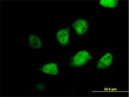 Immunocytochemistry/Immunofluorescence: MLF2 Antibody [H00008079-B01] - Immunofluorescence of purified MaxPab antibody to MLF2 (Cat# H00008079-B01) on HeLa cell . [antibody concentration 10 ug/ml]