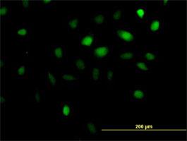 Immunocytochemistry/Immunofluorescence: ANKRD1 Antibody [H00027063-B02] - Immunofluorescence of purified MaxPab antibody to ANKRD1 ( Cat# H00027063-B02 ) on HeLa cell . [antibody concentration 10 ug/ml]