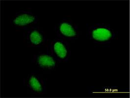 Immunocytochemistry/Immunofluorescence: CENPK Antibody [H00064105-B01] - Immunofluorescence of purified MaxPab antibody to FKSG14 on HeLa cell. [antibody concentration 10 ug/ml]