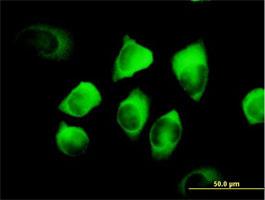 Immunocytochemistry/Immunofluorescence: RRM2 Antibody [H00006241-B01] - RRM2 (H00006241-B01) on HeLa cell . [antibody concentration 10 ug/ml]