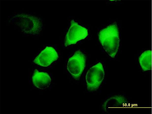 Immunocytochemistry/Immunofluorescence: RRM2 Antibody [H00006241-B01] - RRM2 on HeLa cell. [antibody concentration 10 ug/ml]