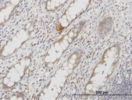 Immunohistochemistry-Paraffin: Aquaporin-8 Antibody (1F8) [H00000343-M03] - Immunoperoxidase of monoclonal antibody to AQP8 on formalin-fixed paraffin-embedded human colon. [antibody concentration 3 ug/ml]
