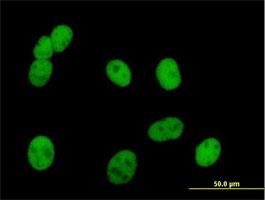 Immunocytochemistry/Immunofluorescence: PMS2 Antibody [H00005395-B01] - Immunofluorescence of purified MaxPab antibody to PMS2 ( Cat# H00005395-B01 ) on HeLa cell . [antibody concentration 10 ug/ml]