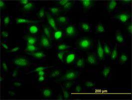 Immunocytochemistry/Immunofluorescence: ZWINT Antibody (6D3) [H00011130-M01] - ZWINT (H00011130-M01) on HeLa cell . [antibody concentration 10 ug/ml]