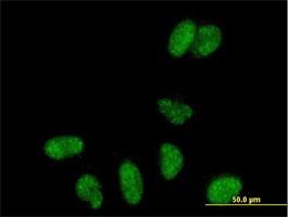 Immunocytochemistry/Immunofluorescence: PPIG Antibody [H00009360-B01] - Immunofluorescence of purified MaxPab antibody to PPIG on HeLa cell. [antibody concentration 10 ug/ml]