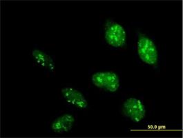 Immunocytochemistry/Immunofluorescence: POLR1D Antibody [H00051082-B01] - Immunofluorescence of purified MaxPab antibody to POLR1D on HeLa cell. [antibody concentration 10 ug/ml]